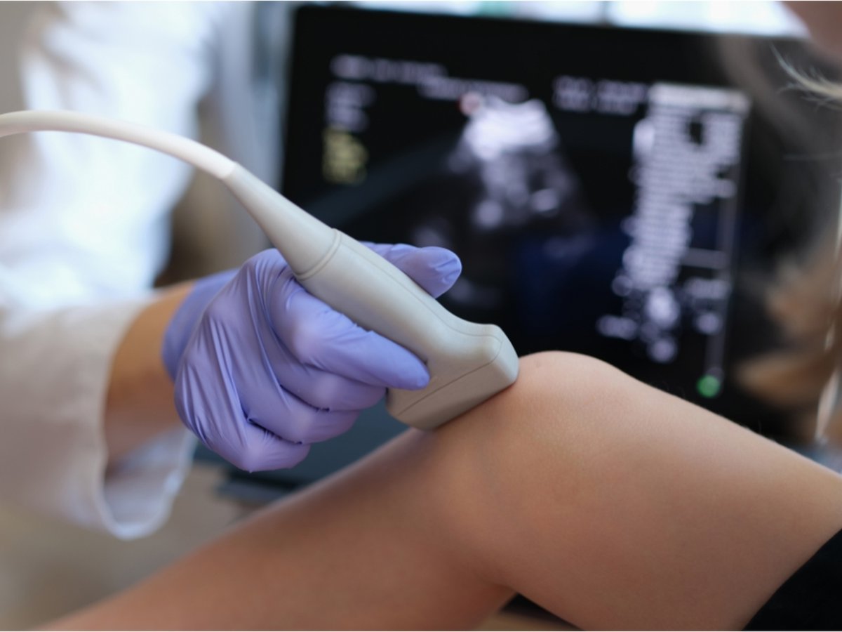 Duplex ultrasound exam for peripheral artery disease (PAD) diagnosis at South Texas Vascular Institute in Edinburg, TX